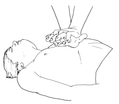 imagine cu masajul cardiac
